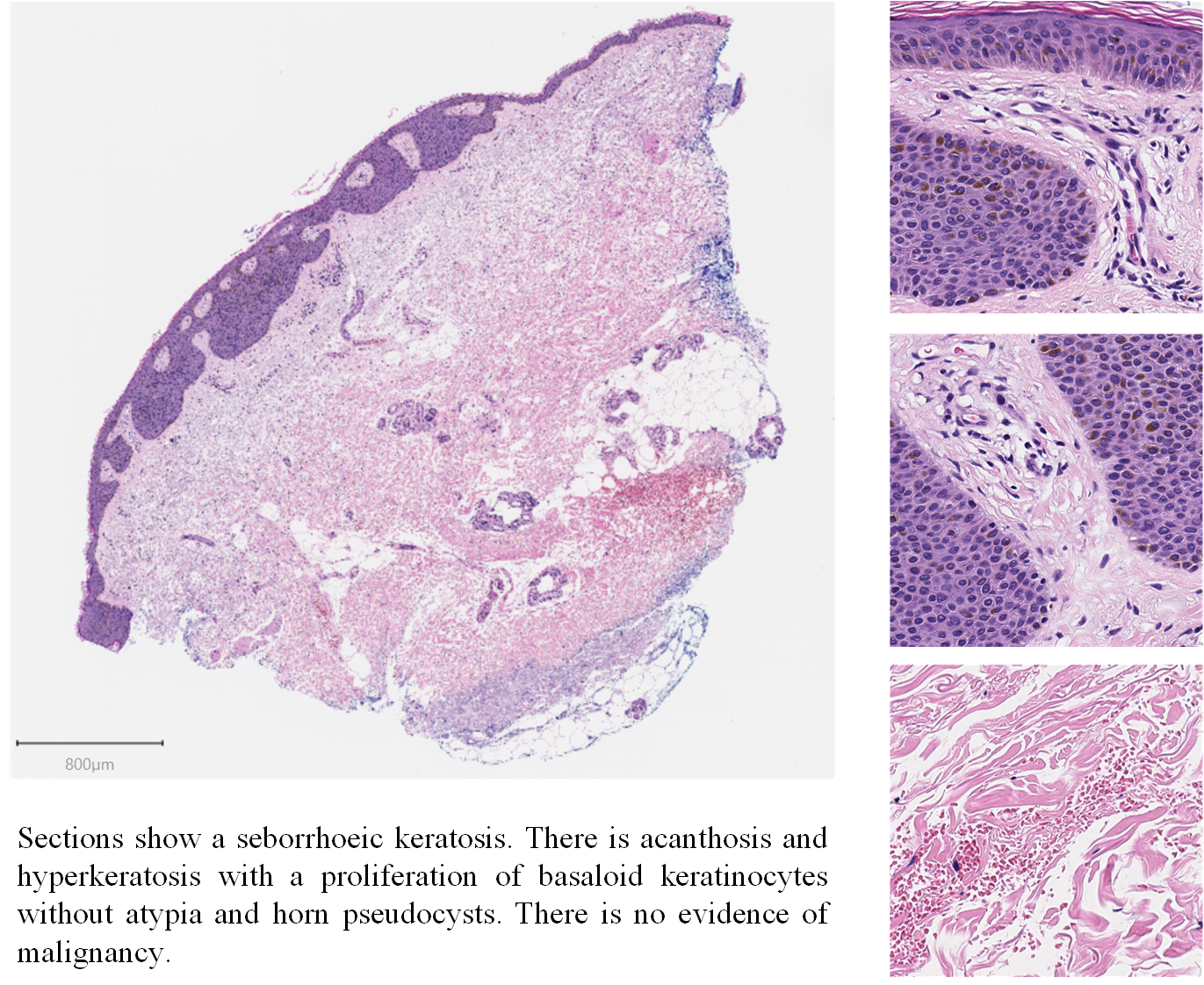Figure 1(a)